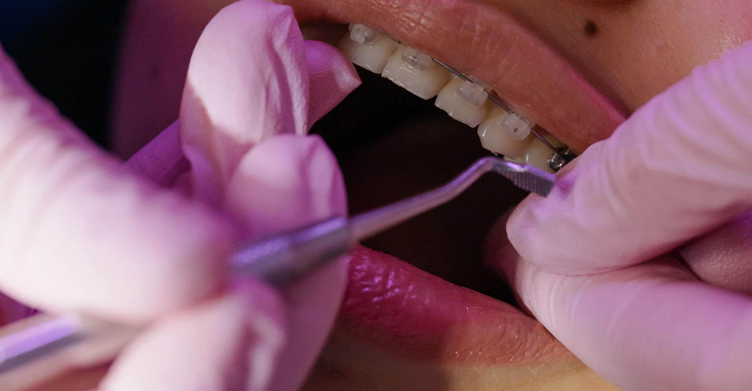 dental-procedure-close-up